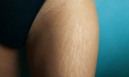 Sex after Pregnancy - Sh! Women's Store